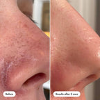 Hero Pore Release - 100ml