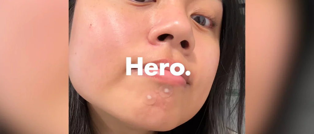 Hero Cosmetics Mighty Patch Original - 72ct